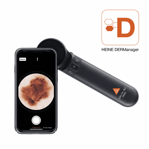 HEINE DELTA 30 PRO Dermatoskop